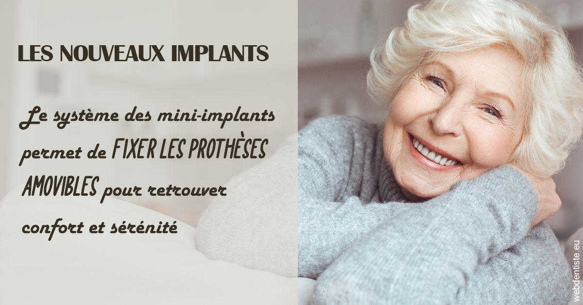 https://dr-jan-patrick.chirurgiens-dentistes.fr/Les nouveaux implants 1