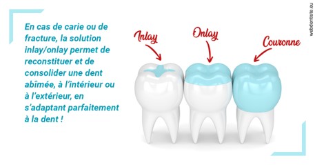 https://dr-jan-patrick.chirurgiens-dentistes.fr/L'INLAY ou l'ONLAY