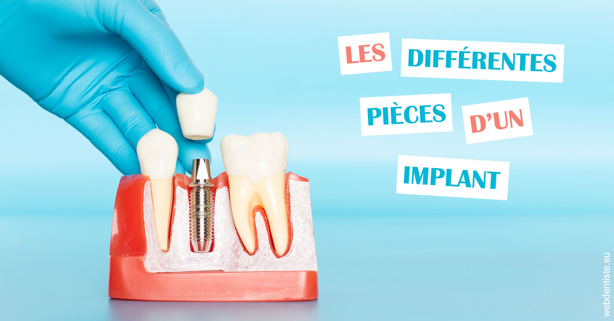 https://dr-jan-patrick.chirurgiens-dentistes.fr/Les différentes pièces d’un implant 2