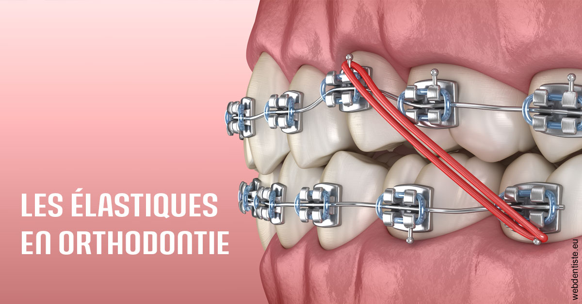 https://dr-jan-patrick.chirurgiens-dentistes.fr/Elastiques orthodontie 2