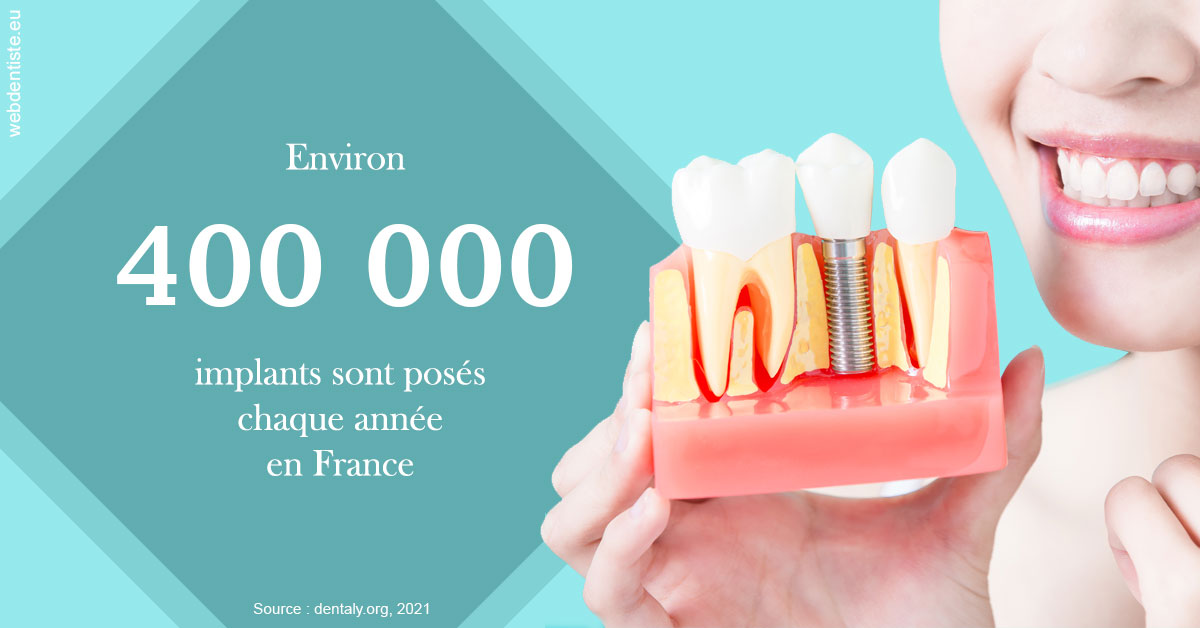 https://dr-jan-patrick.chirurgiens-dentistes.fr/Pose d'implants en France 2